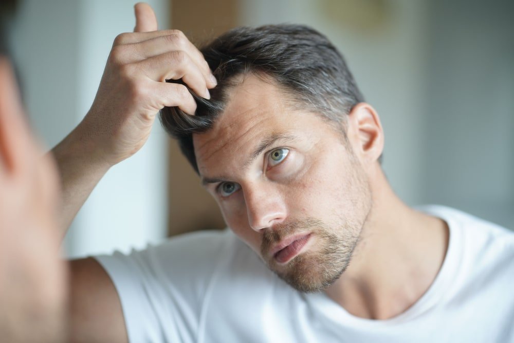 Pet saveta da muškarac uspori gubitak kose i reši se peruti | To sam ja
