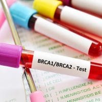 Epruveta sa uzorcima krvi, spremne za BRCA testiranje.