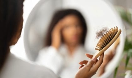 U ogledalu se vidi zamućena slika žene koja u ruci drži četku za kosu nakojoj je puno opalih dlaka.