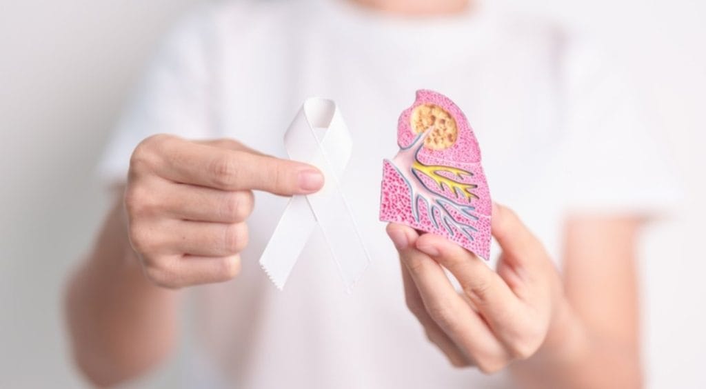 Doktor koji u rukama drži model pluća i belu traku, koja je simbol podizanja svesti o raku pluća.