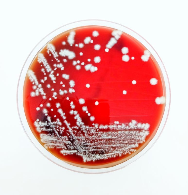 Kandida rast u laboratoriji u petri solji.