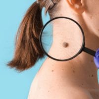 Dermatolog posmatra mladež na vratu žene kroz lupu.