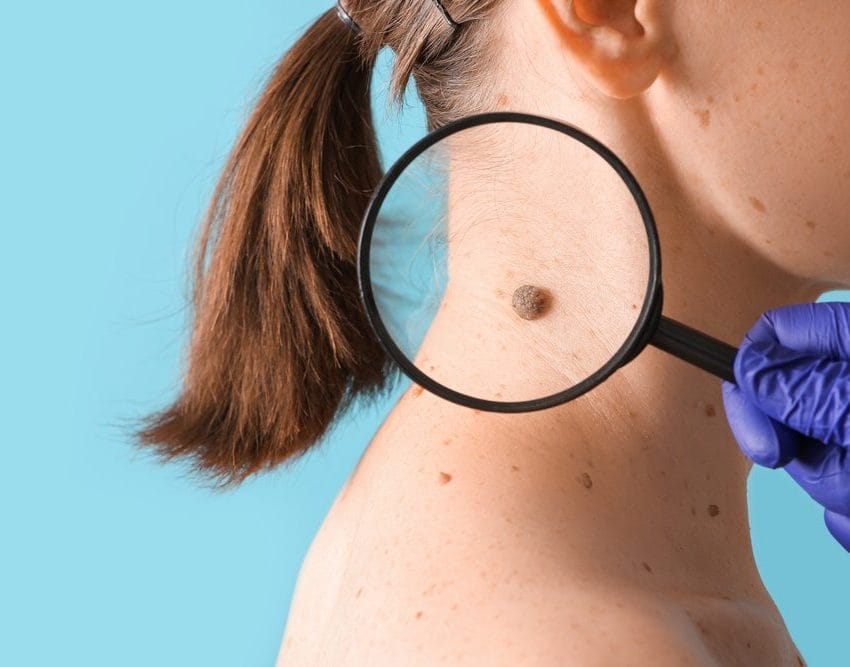 Dermatolog posmatra mladež na vratu žene kroz lupu.