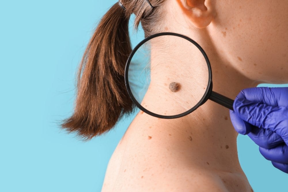 Dermatolog posmatra mladež na vratu žene kroz lupu.