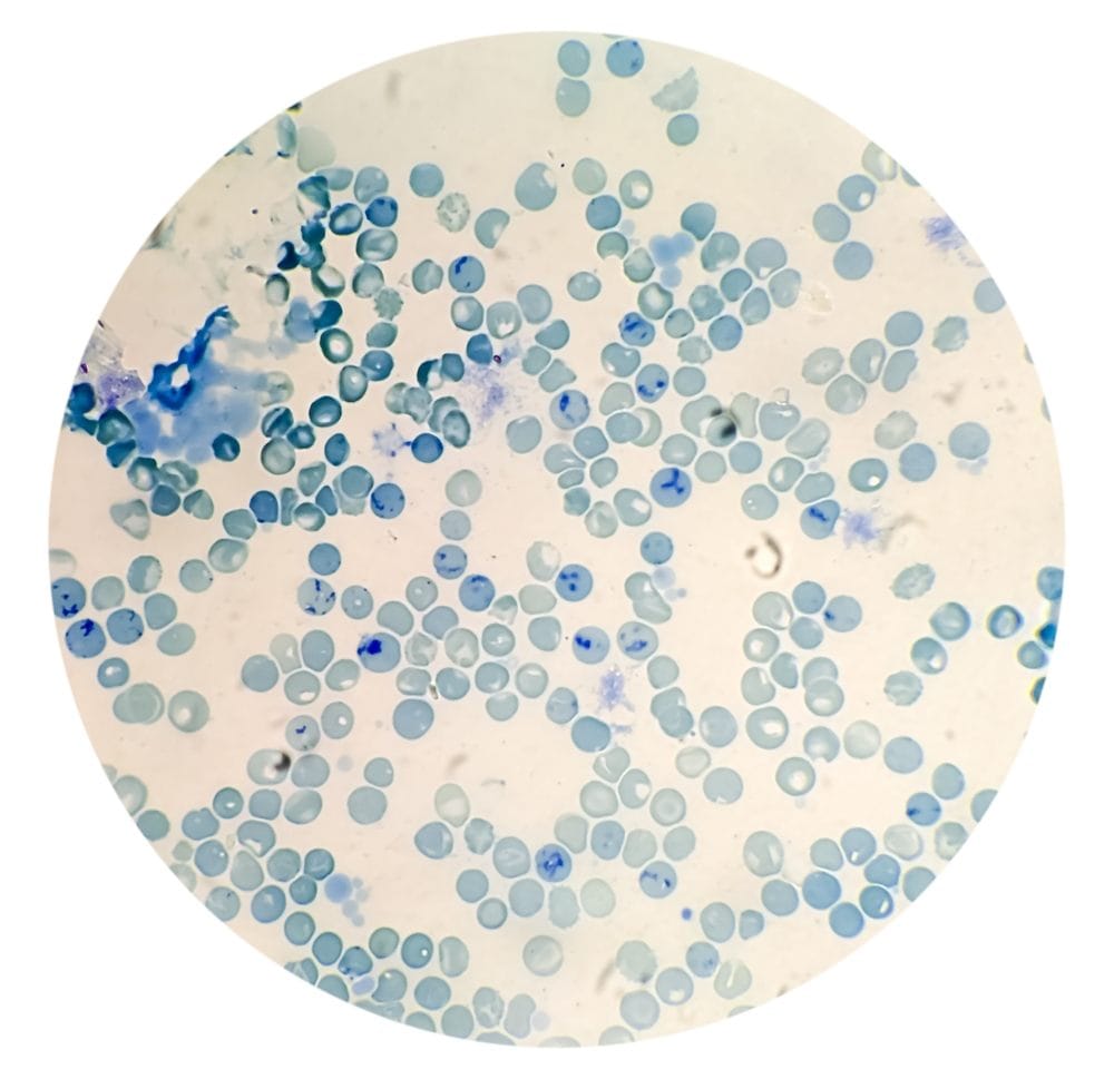 Brojanje retikulocita, obojenih metilen plavom, iz krvnog razmaza-hematologija