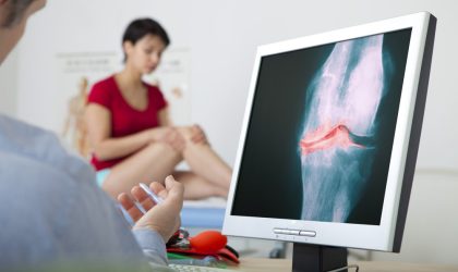 Pregled kolena žene u doktorskoj ordinaciji, na ekranu je rentgenski snimak zgloba kolena.