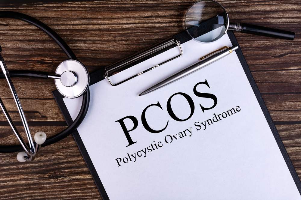 Stetoskop na stolu, papir na kome piše PCOS-polycistic ovary syndrome.
